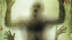 The Human Centipede (First Sequence) Image 3